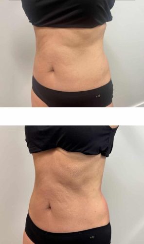 116753-abdomen-3-txt-2-c3-e1749022333783