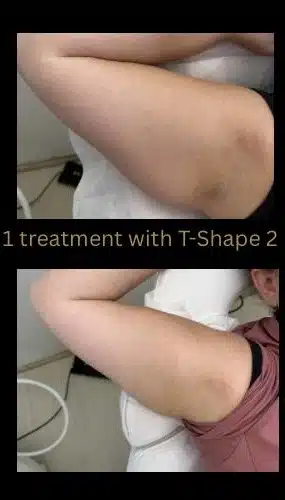 12033-Tshape-c2.jpeg