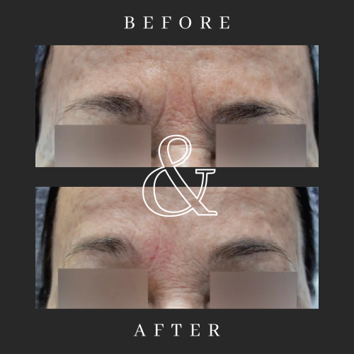 Black-and-White-Lash-Tech-Before-and-After-Instagram-Post