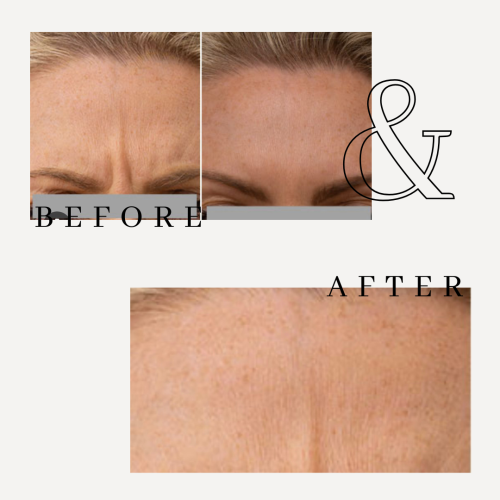 Minimal-Lash-Extensions-Before-and-After-Instagram-Post