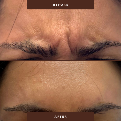 Simple-Photocentric-Before-and-After-Instagram-Post